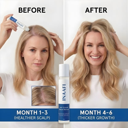 Inaafi™ Regrowth Serum